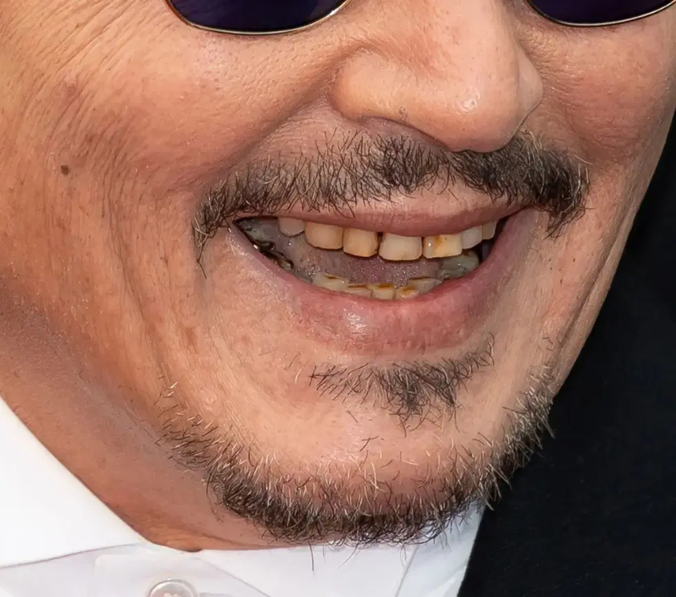 أسنان الممثل جوني ديب 