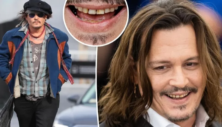 أسنان الممثل جوني ديب محط أنظار المتابعين