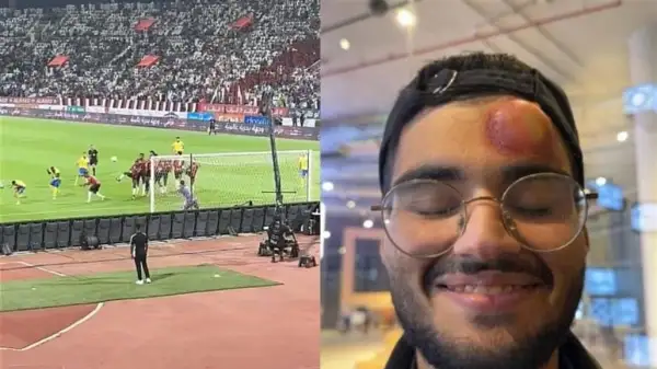 تداول فيديو لإصابة مصور برأسه بسبب تسديدة كريستيانو رونالدو